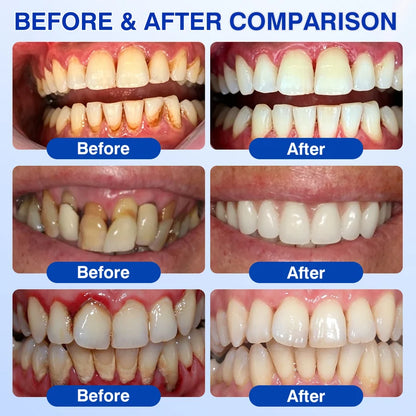 🇺🇸🏆🦷✨GINGEVION™ GumRevive Periodontal Repair Gel