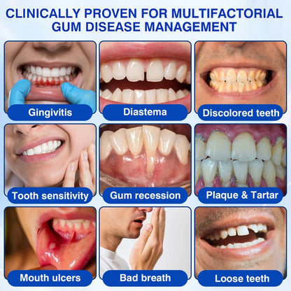 🇺🇸🏆🦷✨GINGEVION™ GumRevive Periodontal Repair Gel