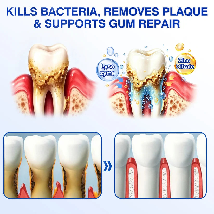 🇺🇸🏆🦷✨GINGEVION™ GumRevive Periodontal Repair Gel