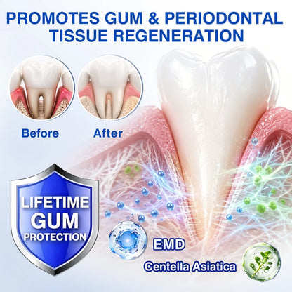 🇺🇸🏆🦷✨GINGEVION™ GumRevive Periodontal Repair Gel
