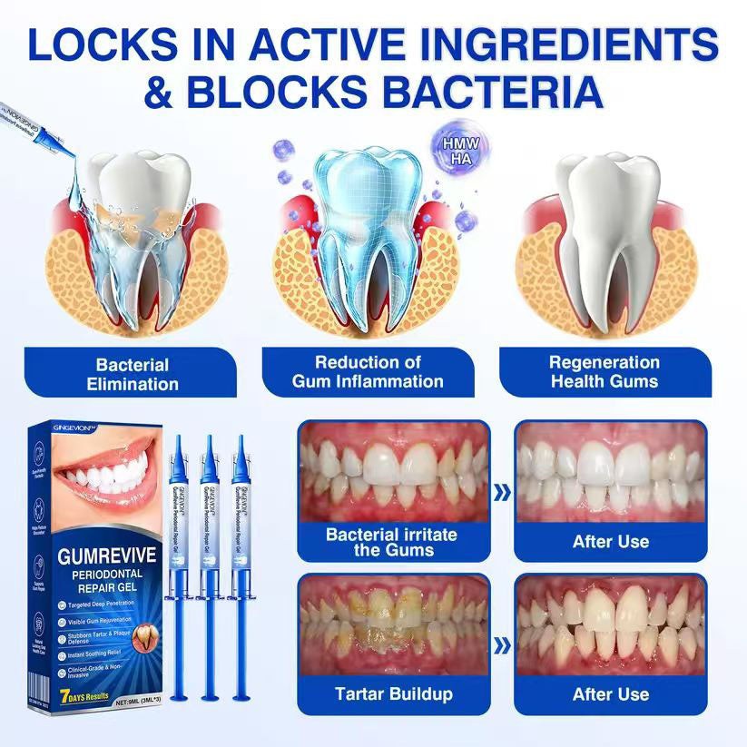 🇺🇸🏆🦷✨GINGEVION™ GumRevive Periodontal Repair Gel
