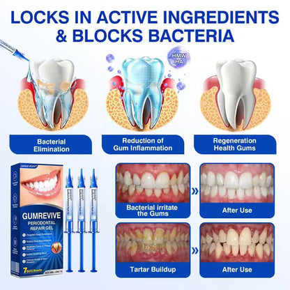 🇺🇸🏆🦷✨GINGEVION™ GumRevive Periodontal Repair Gel